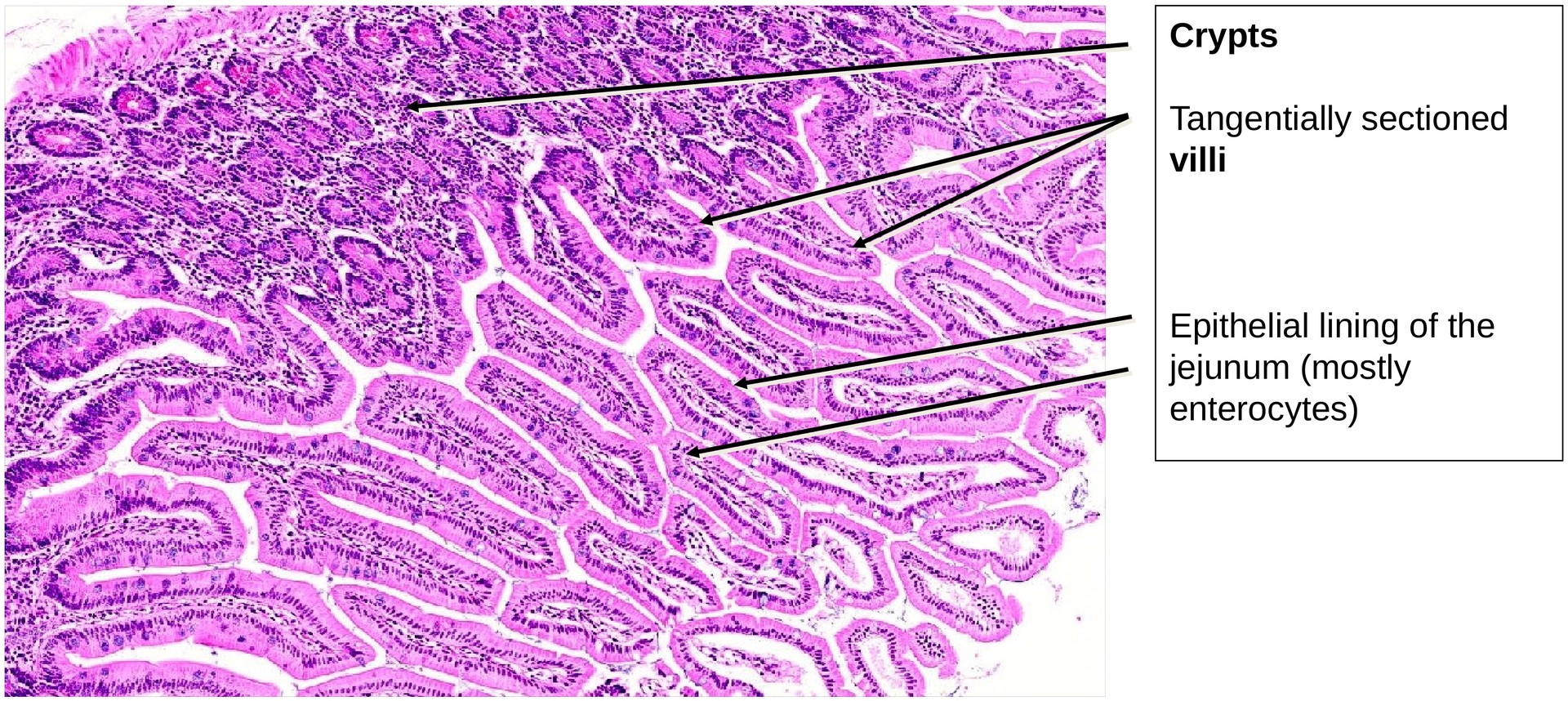 Jejunum, human 2