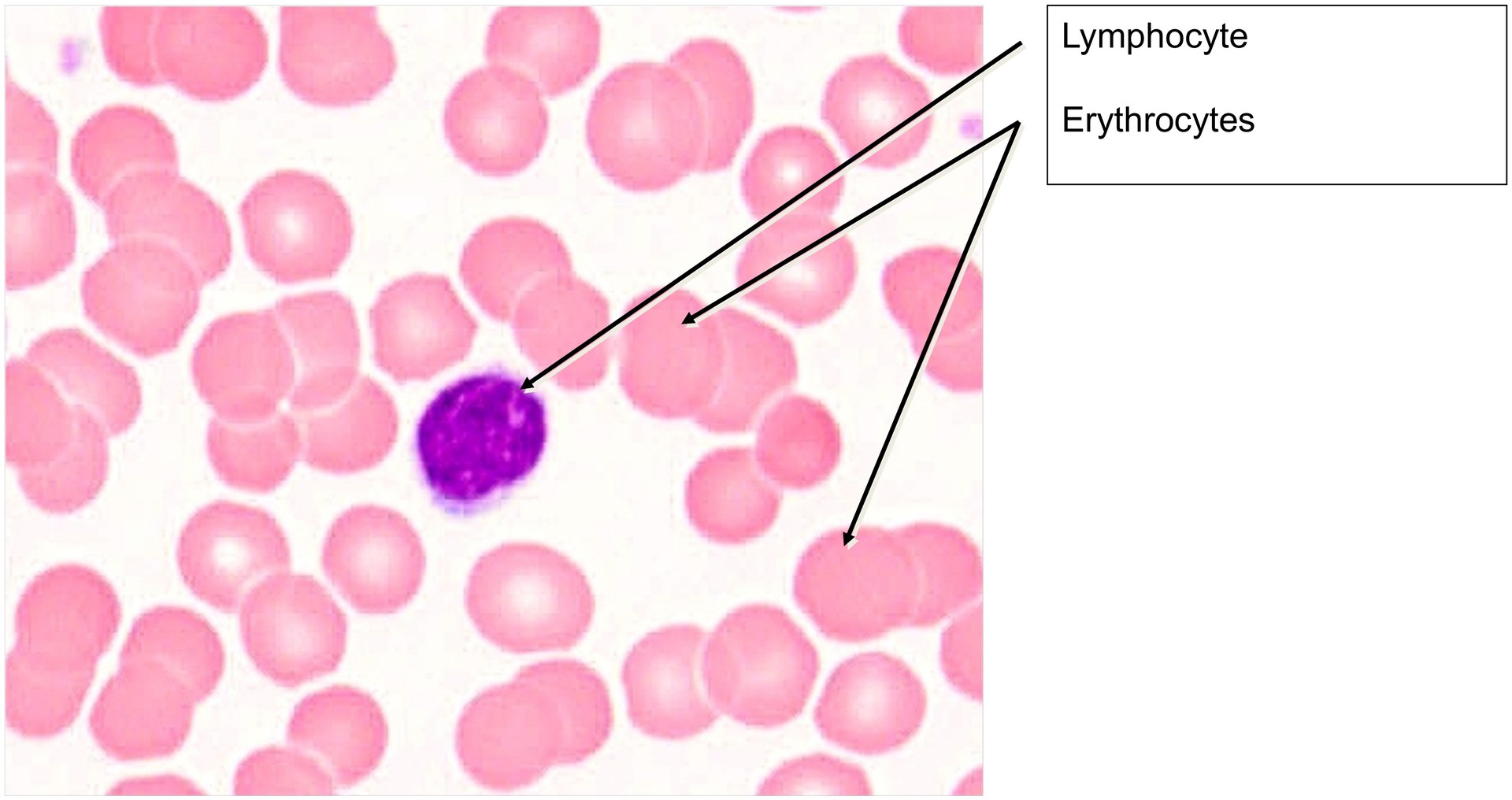 Blood smear