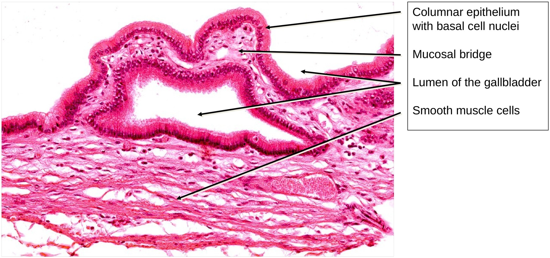 Gallbladder