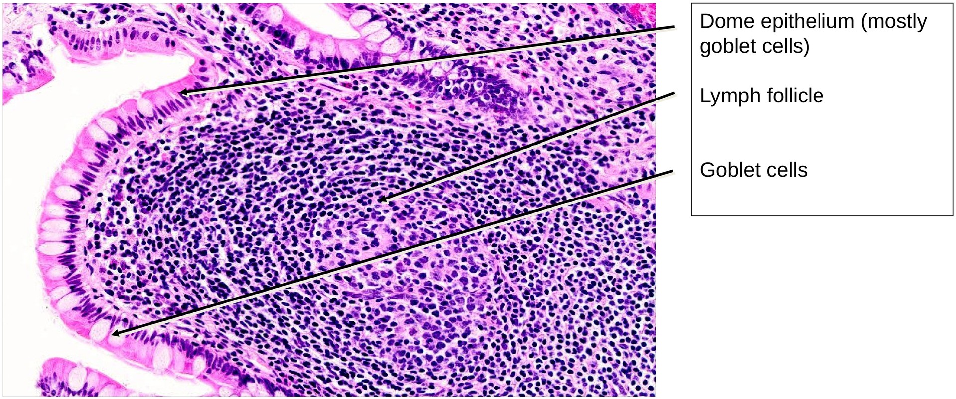 Ileum, Human 2