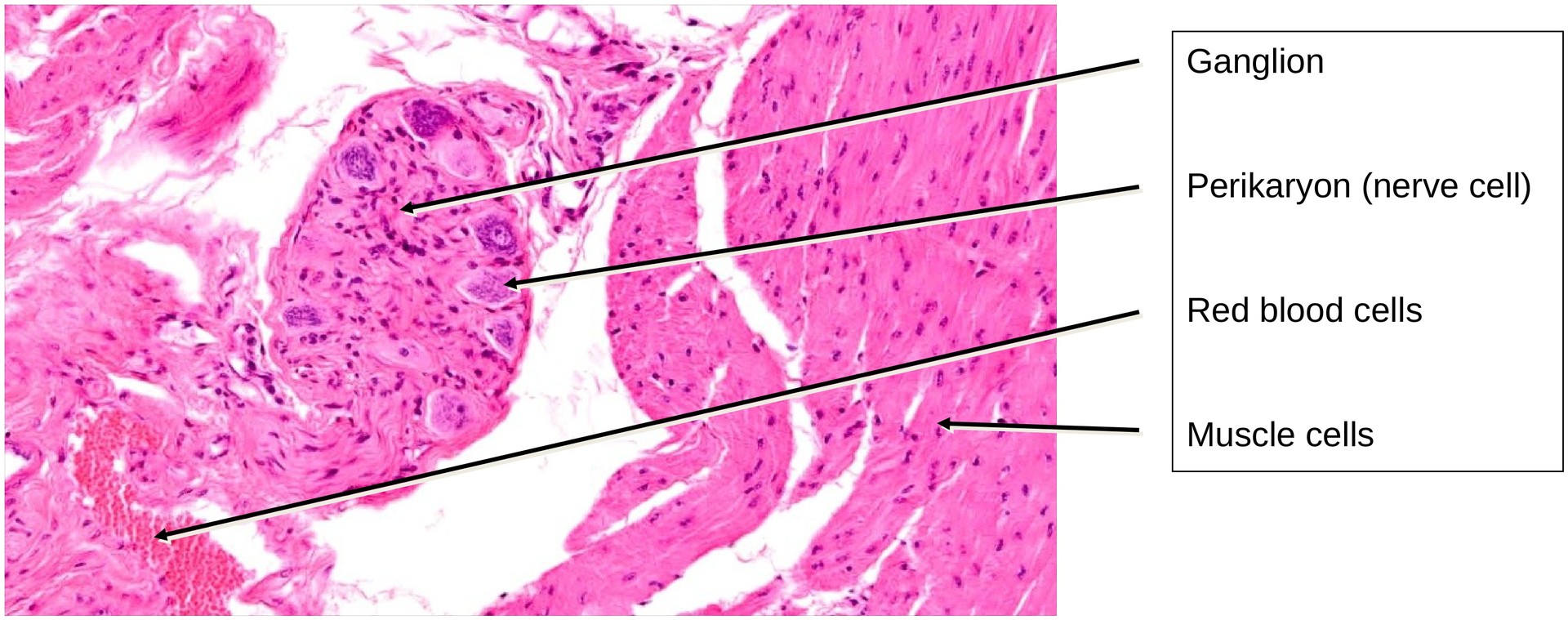 Transitional epithelium (urinary bladder)
