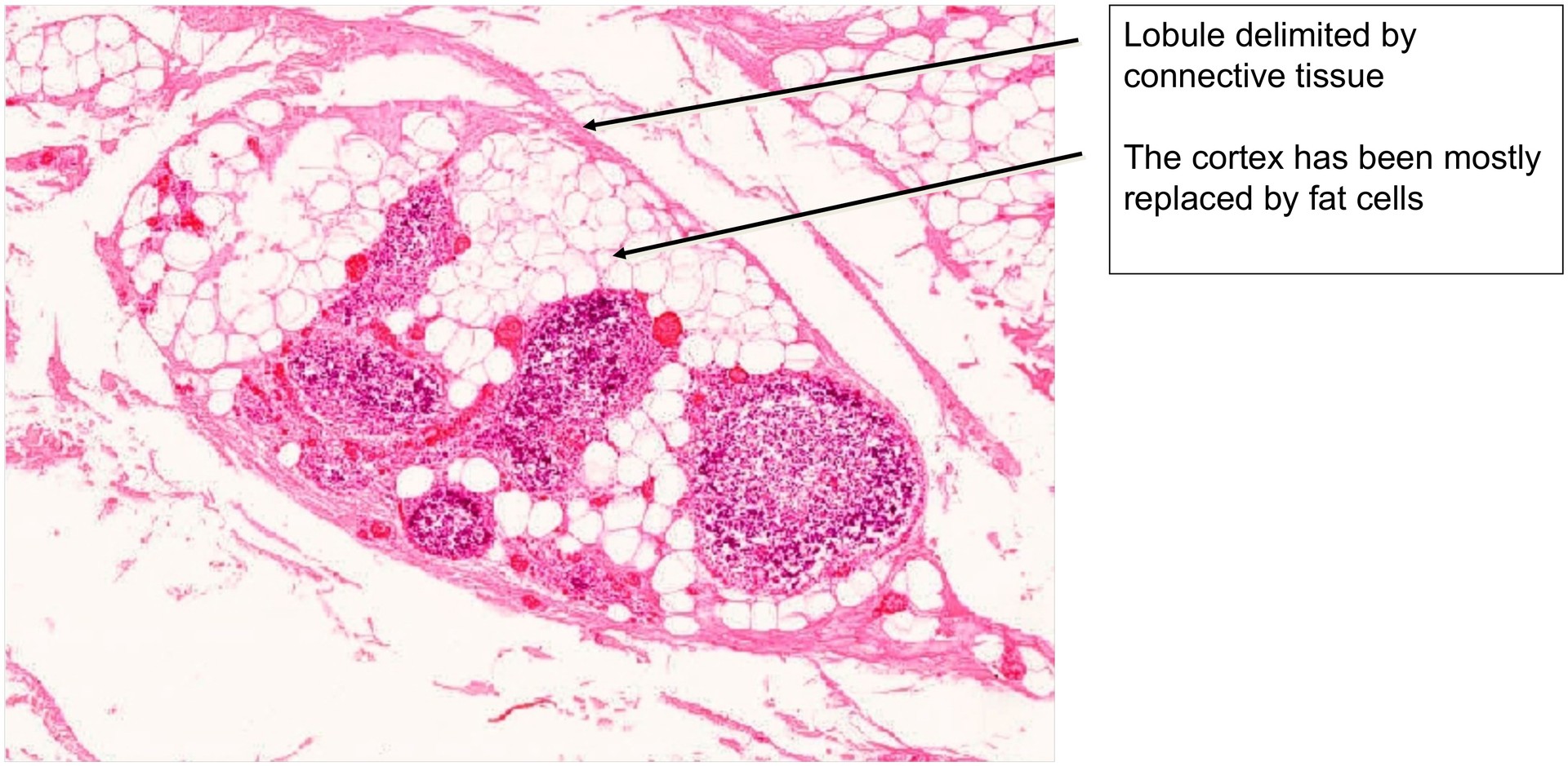 Thymus, adult