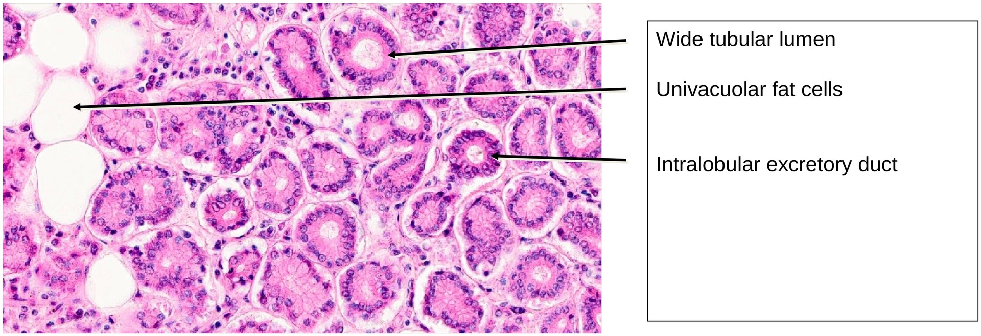 Lacrimal gland
