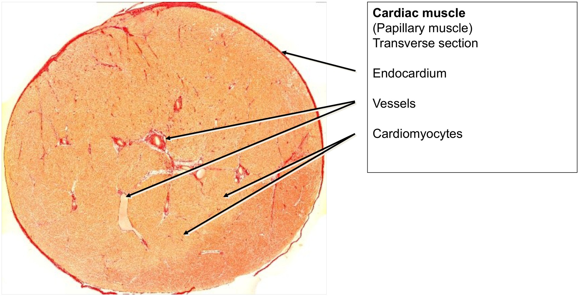 Papillary muscle