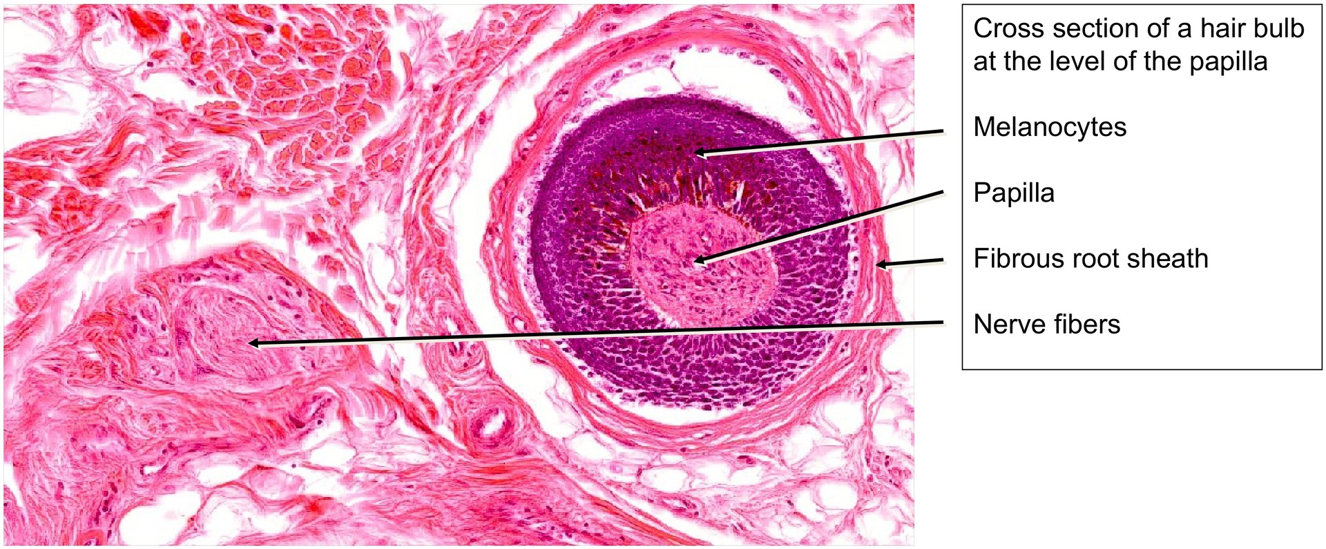 Scalp, cross