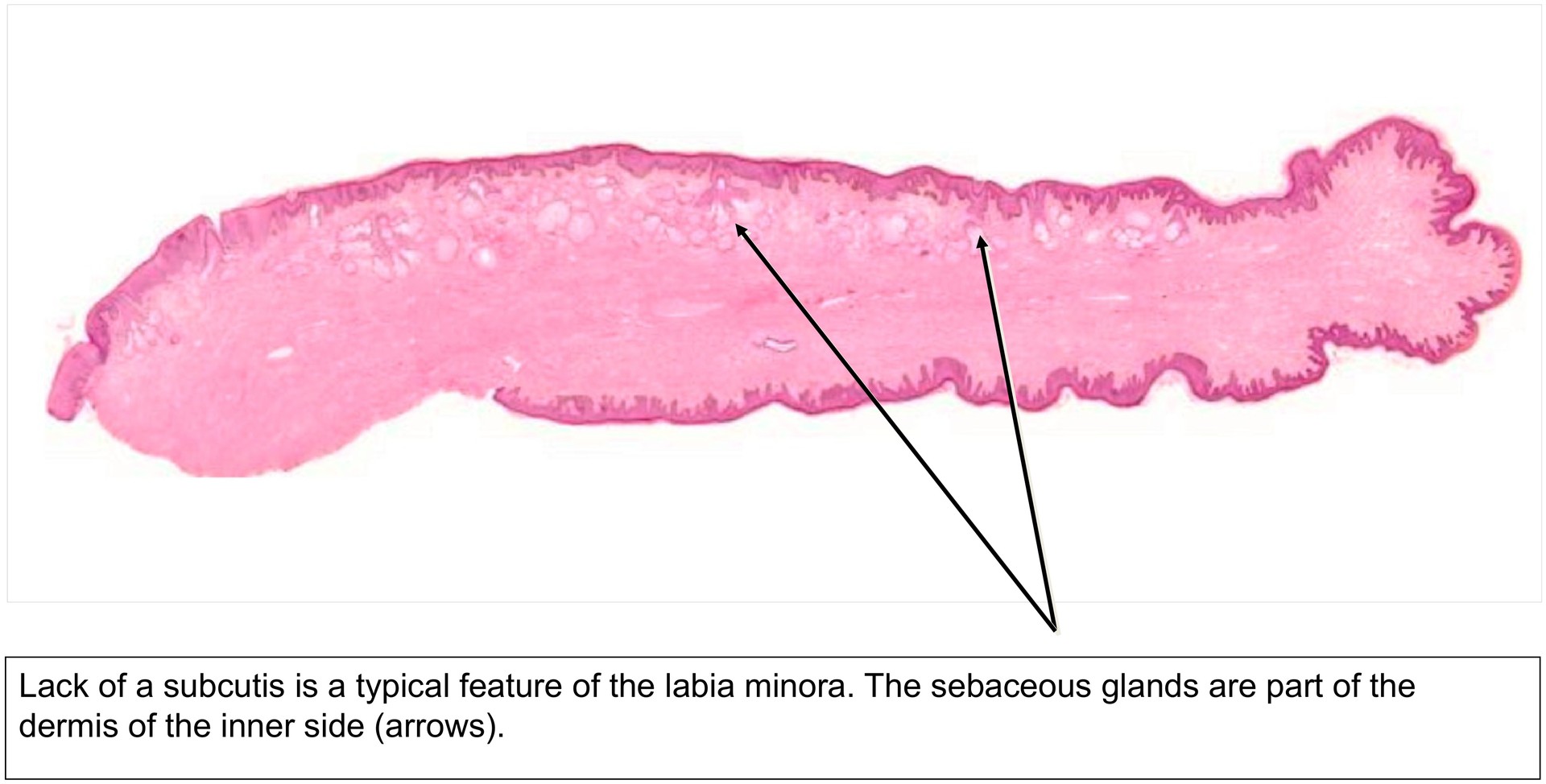 Labium minus