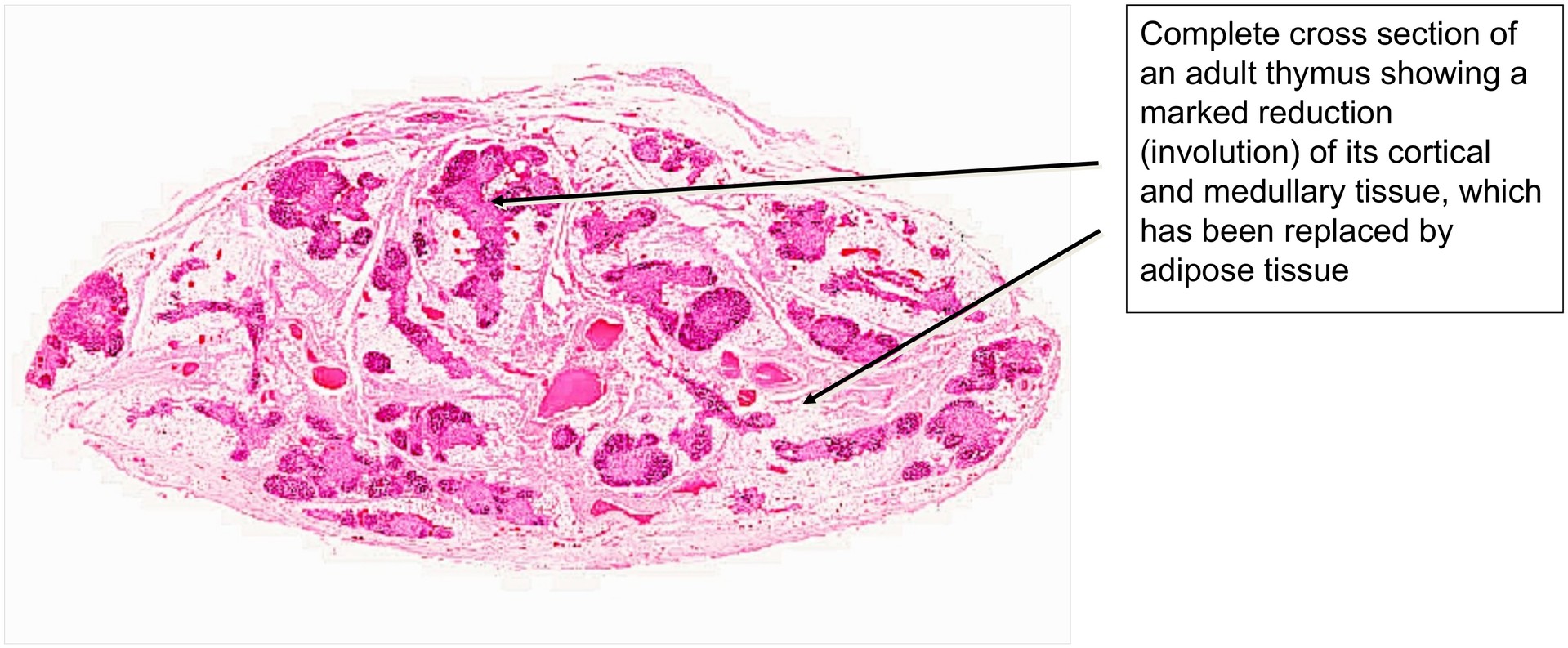 Thymus, adult