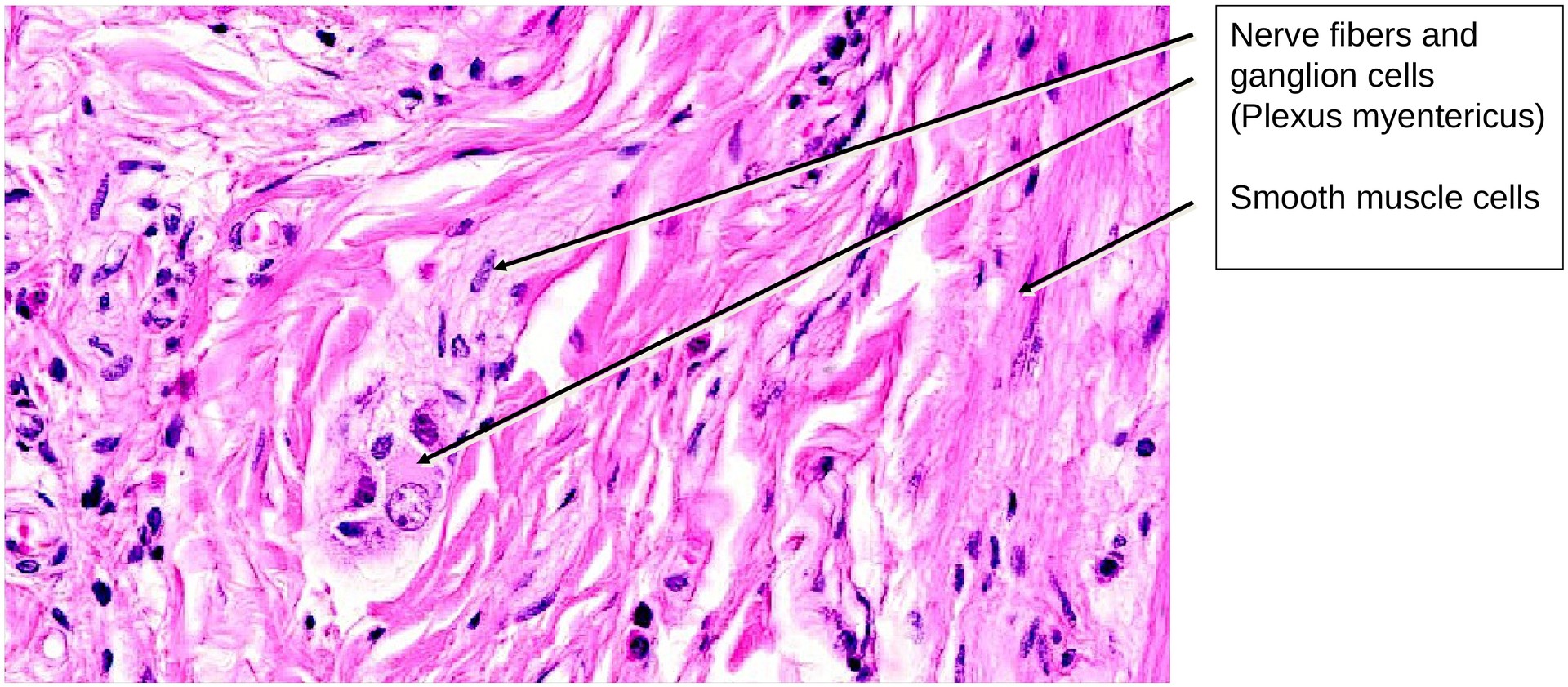 Jejunum, human 2