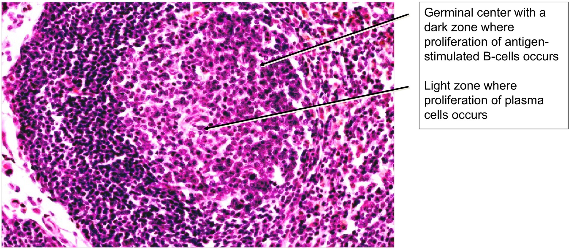 Lymph node, dog