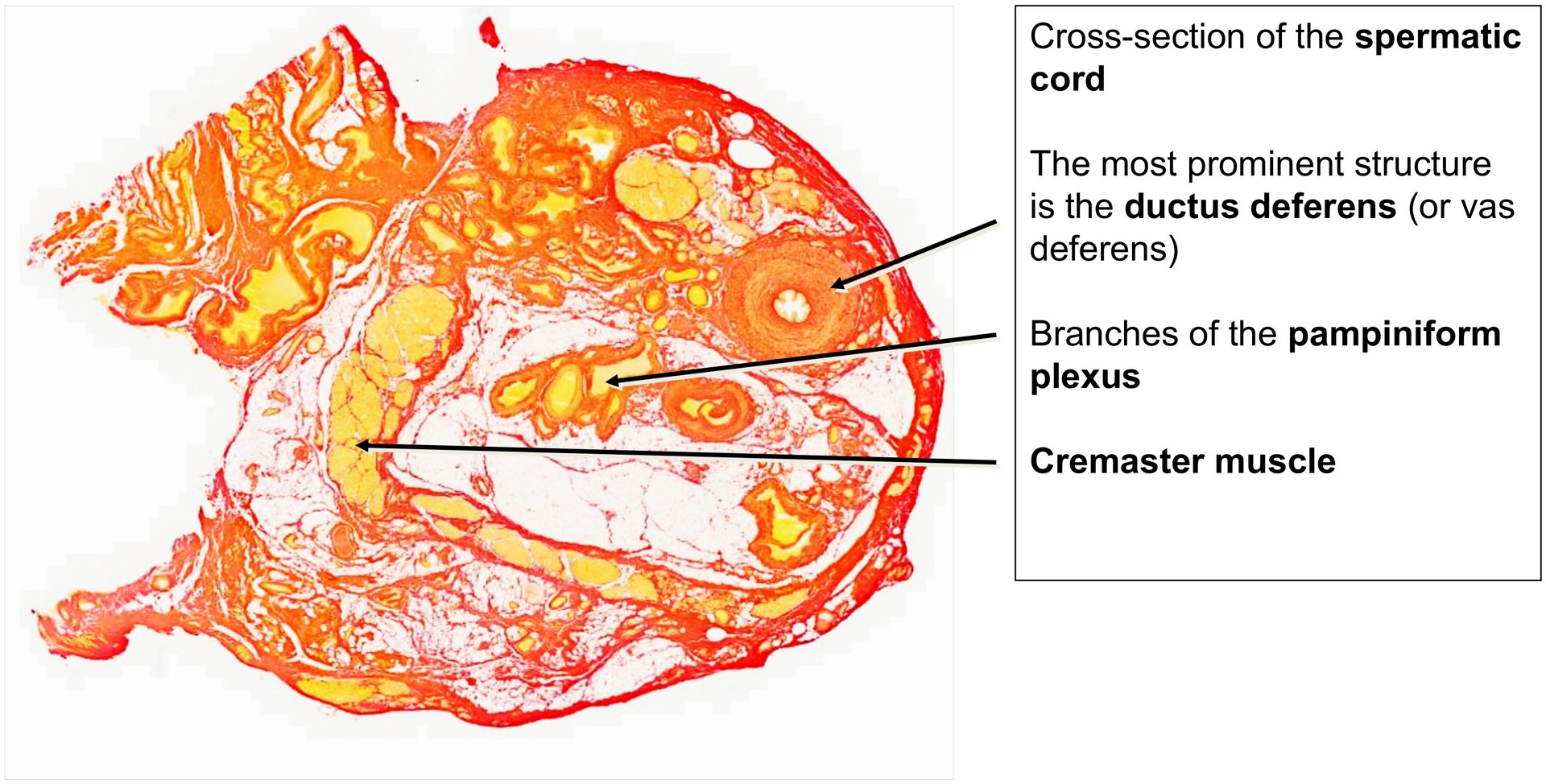 Spermatic cord