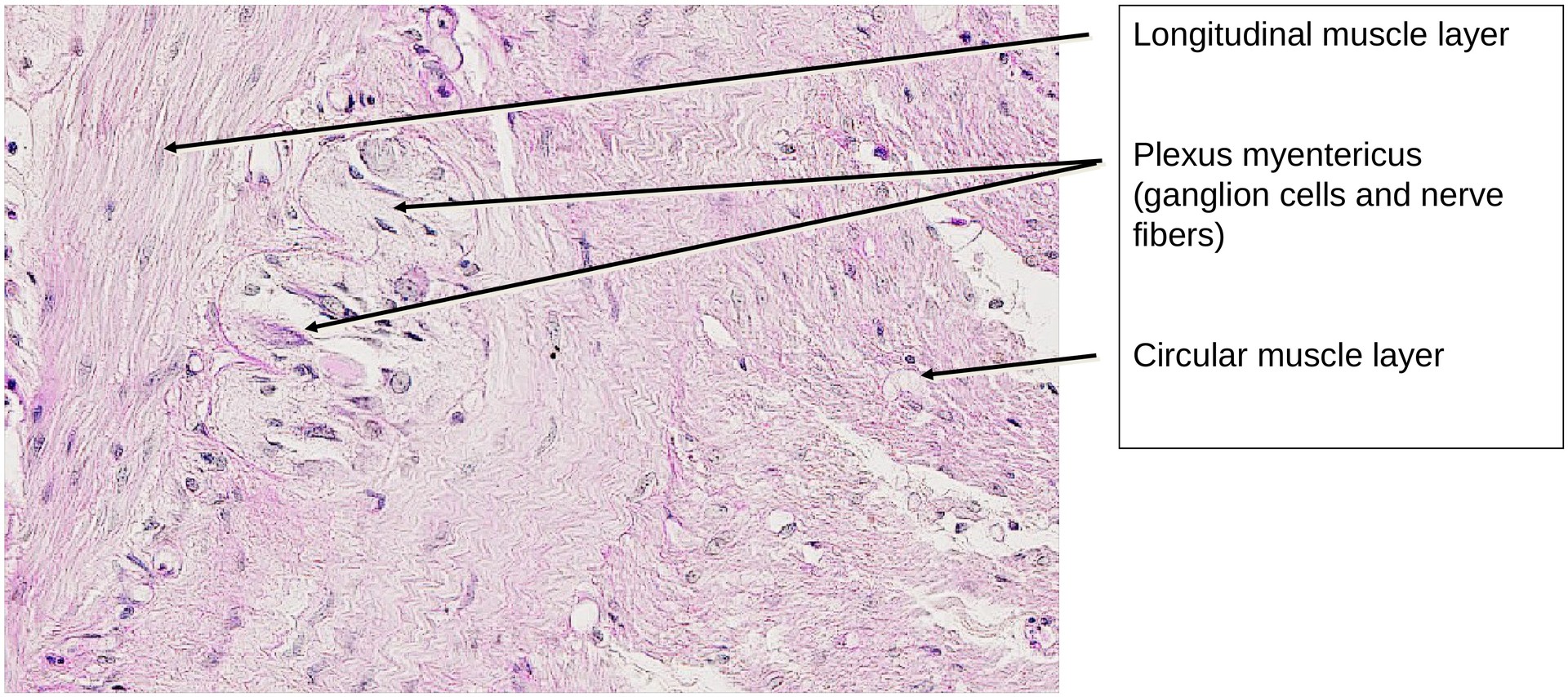 Jejunum, human 1
