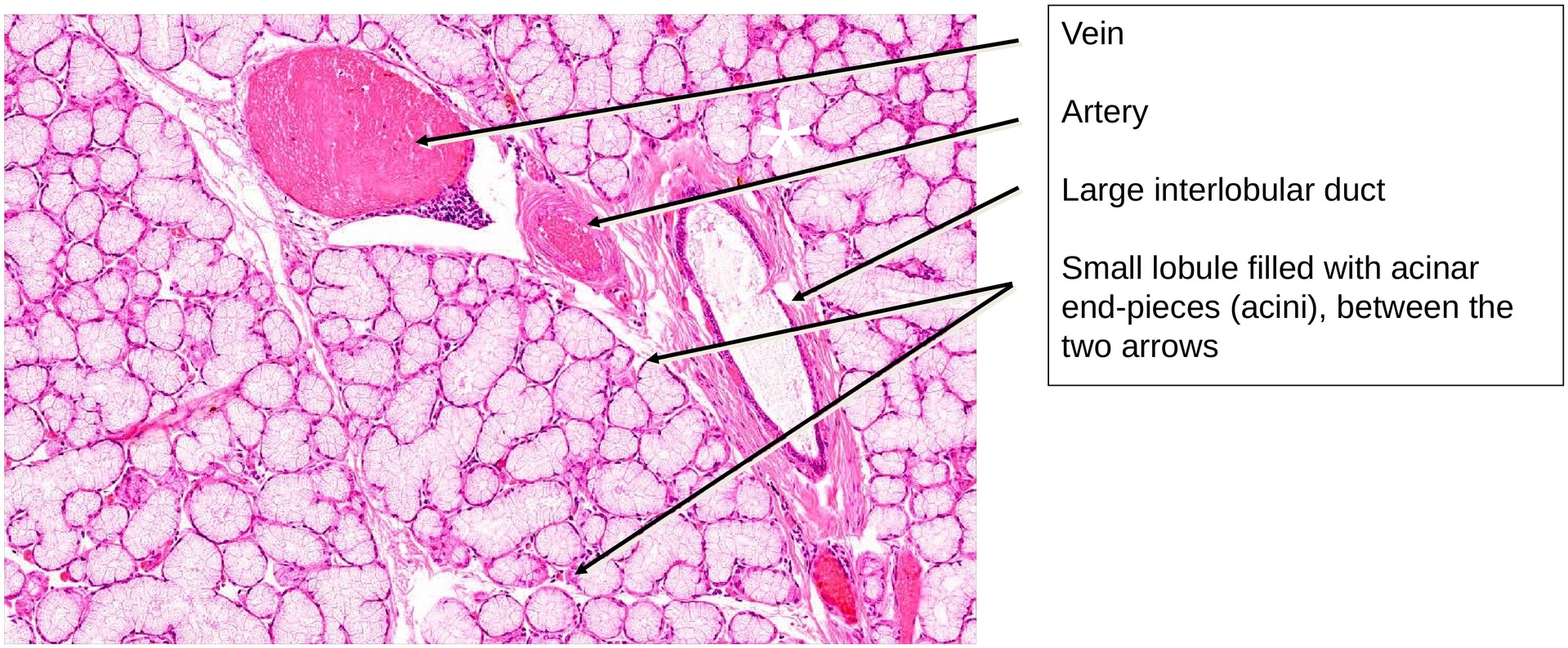 Sublingual gland 1