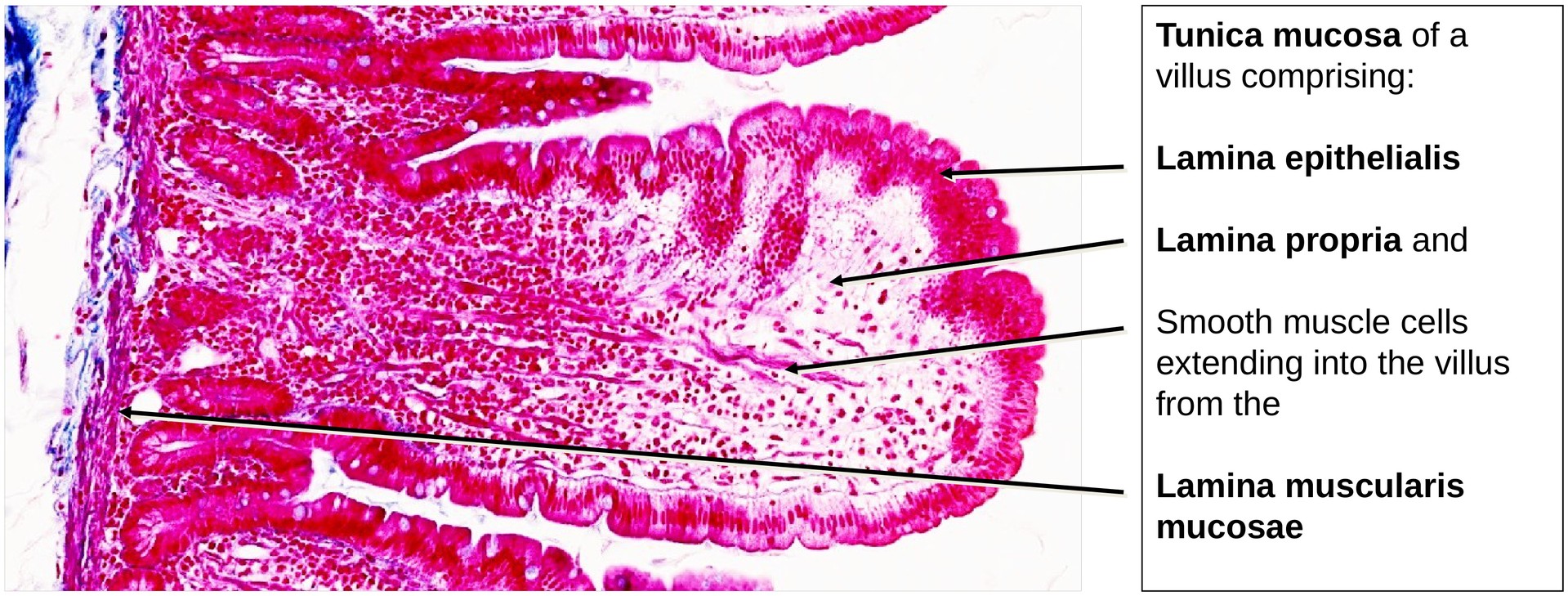 Duodenum