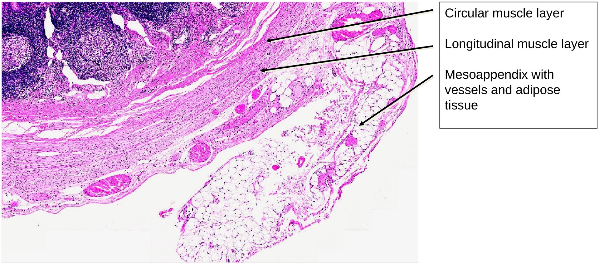 Vermiform appendix