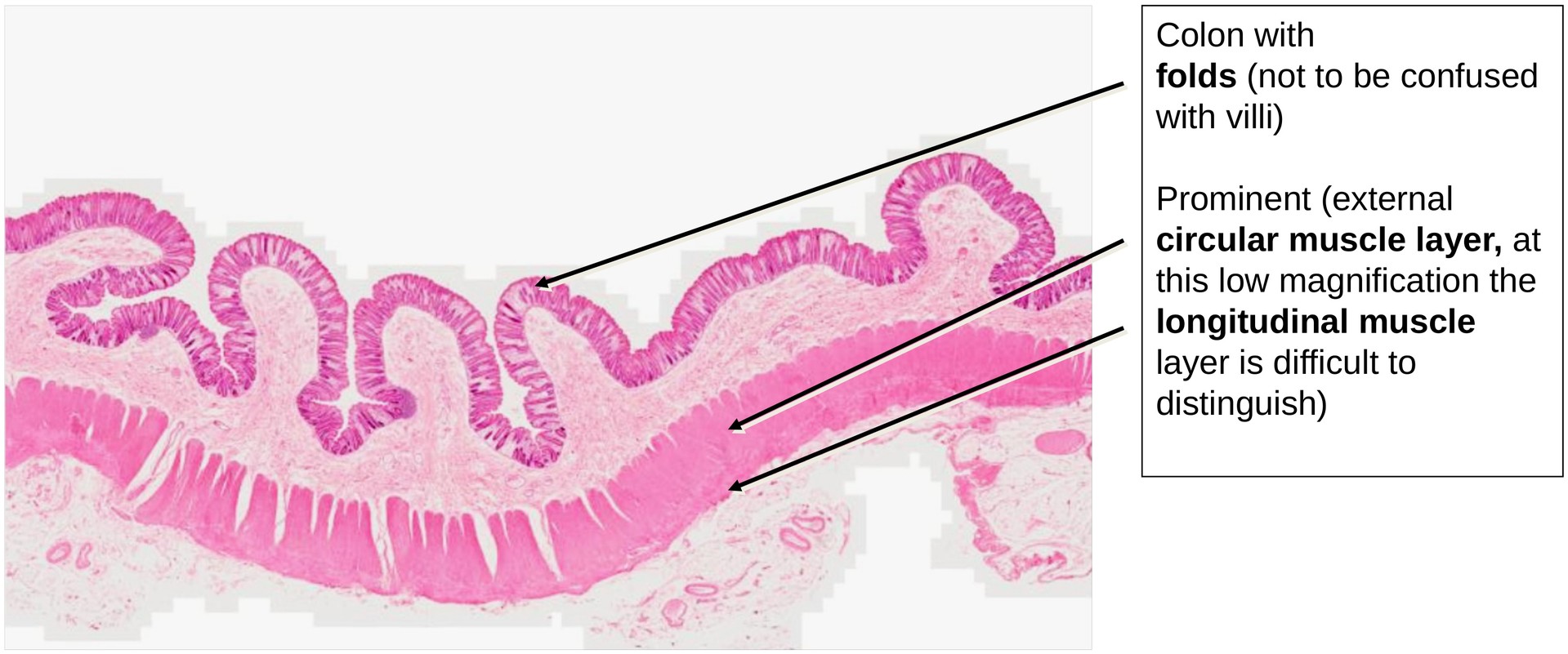 Colon