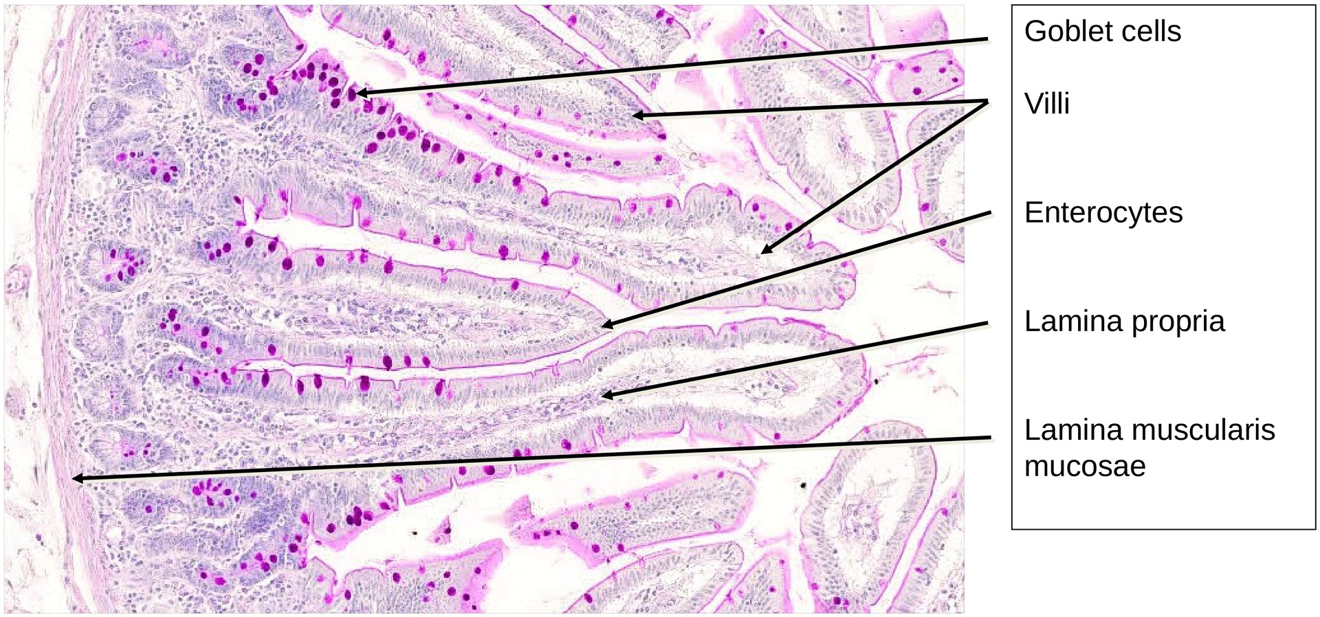 Jejunum, human 1