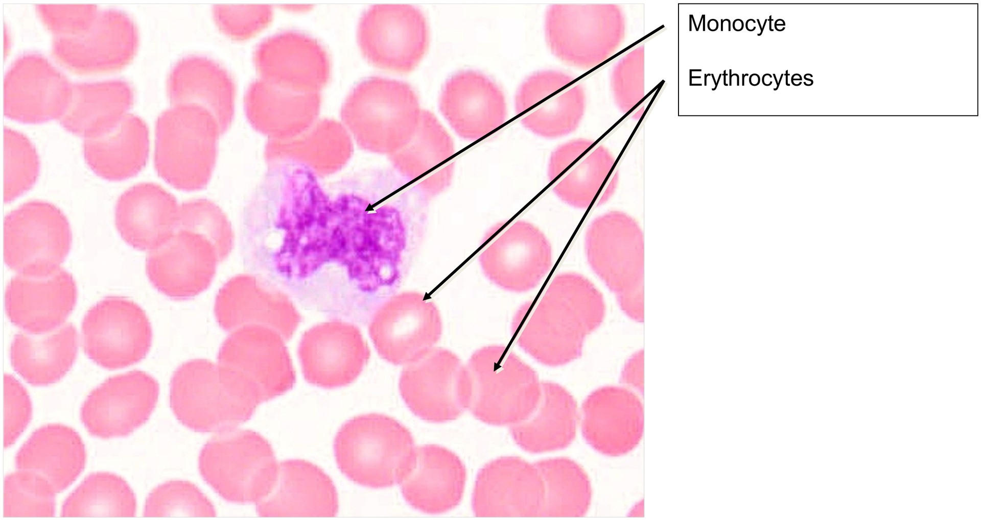 Blood smear
