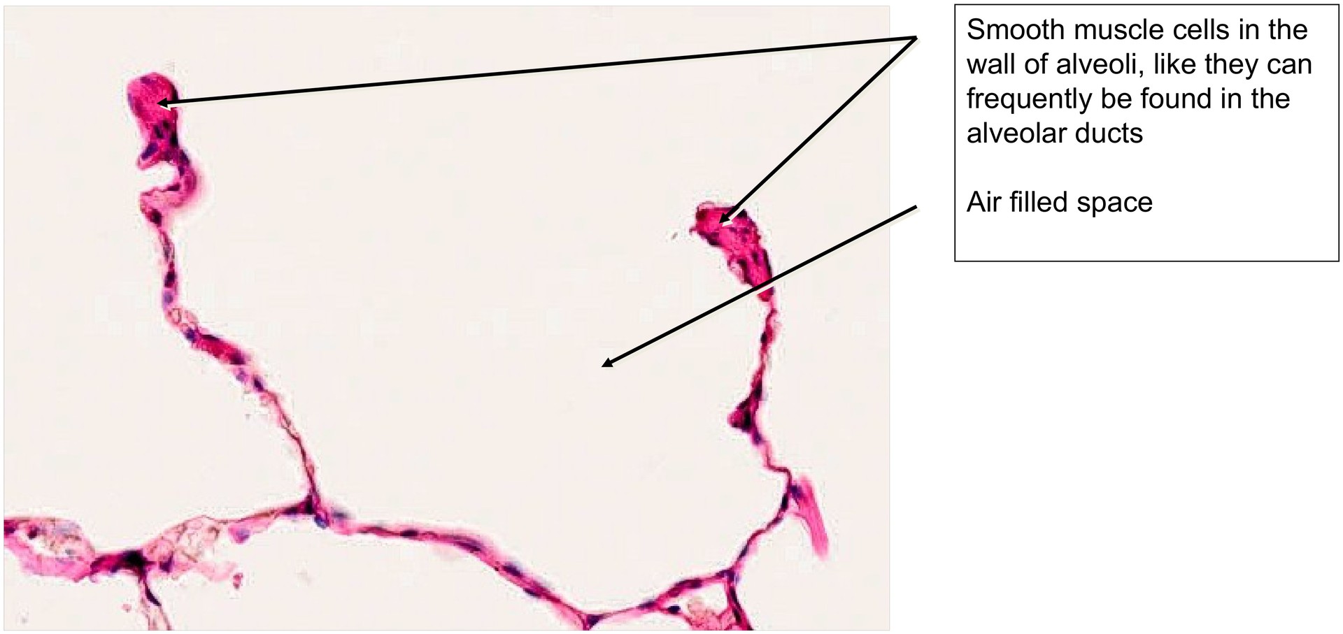 Lung adult