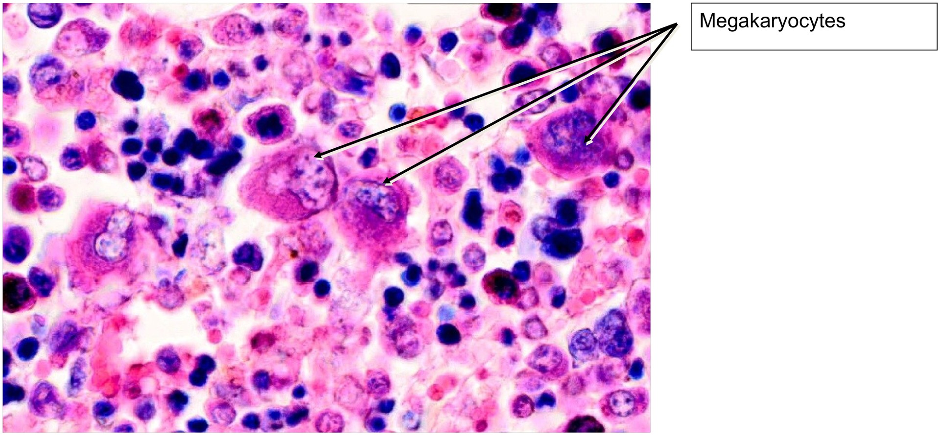 Bone marrow