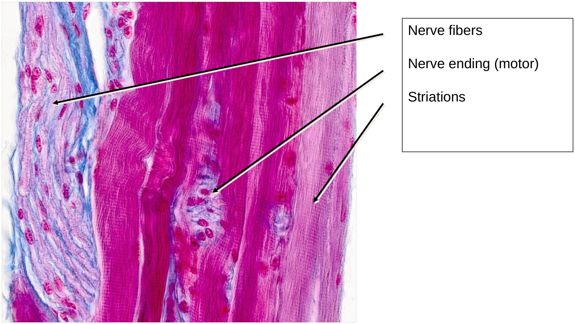 Skeletal muscle (longitudinal)