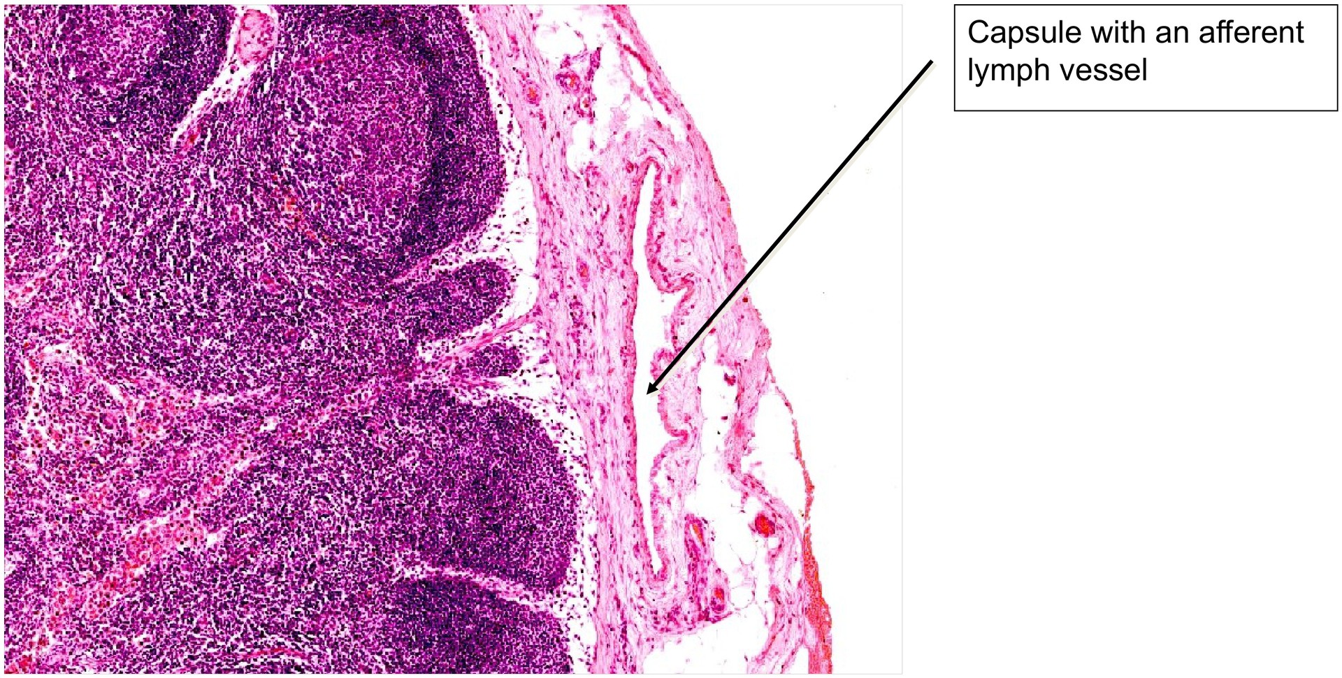 Lymph node, dog