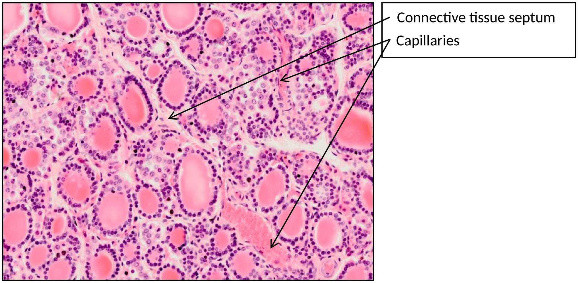 Thyroid gland