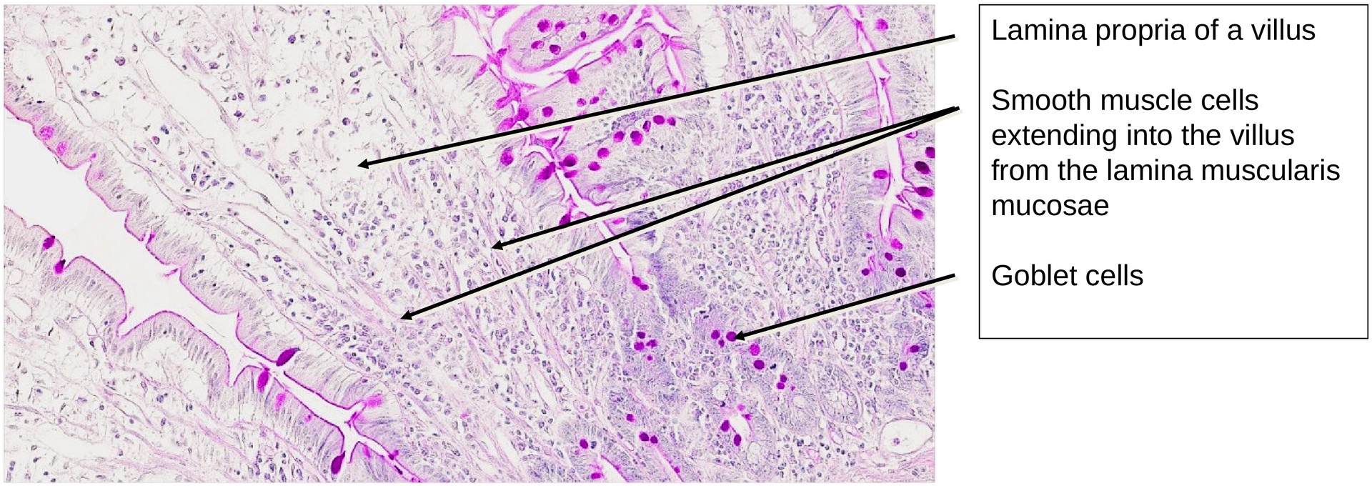 Jejunum, human 1