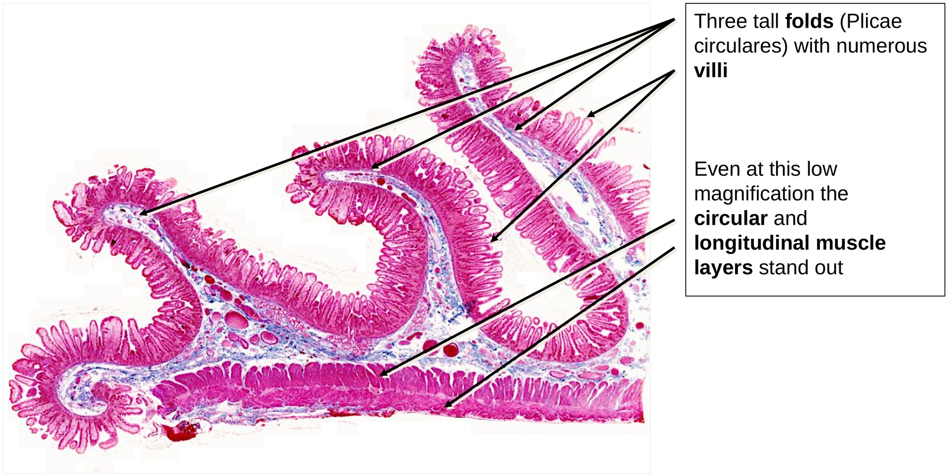 Duodenum