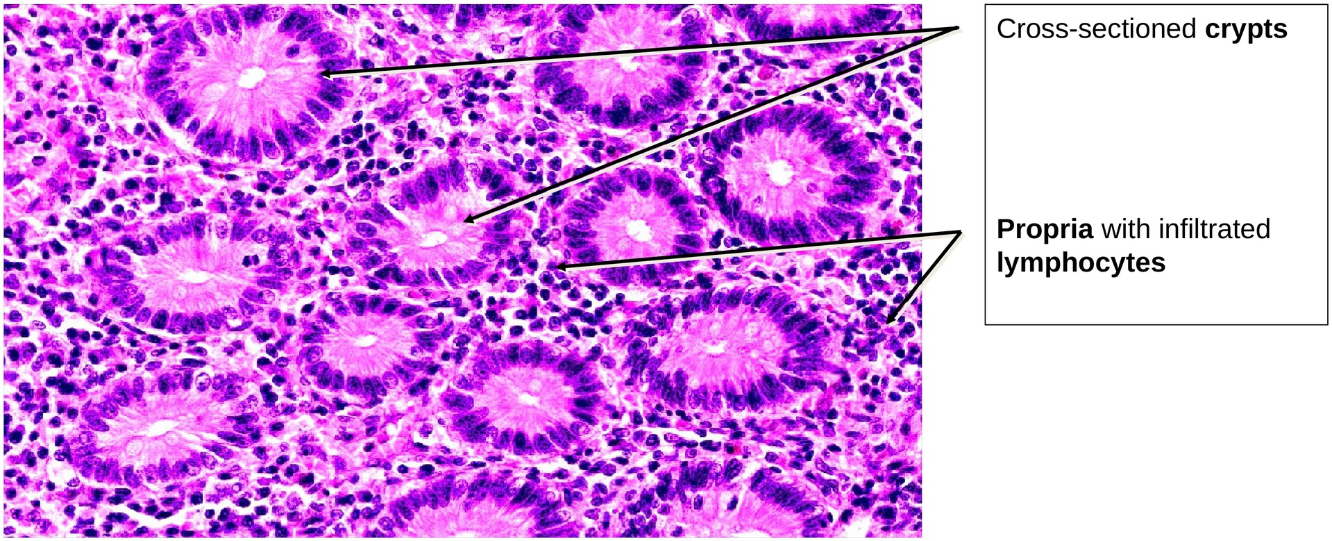 Vermiform appendix