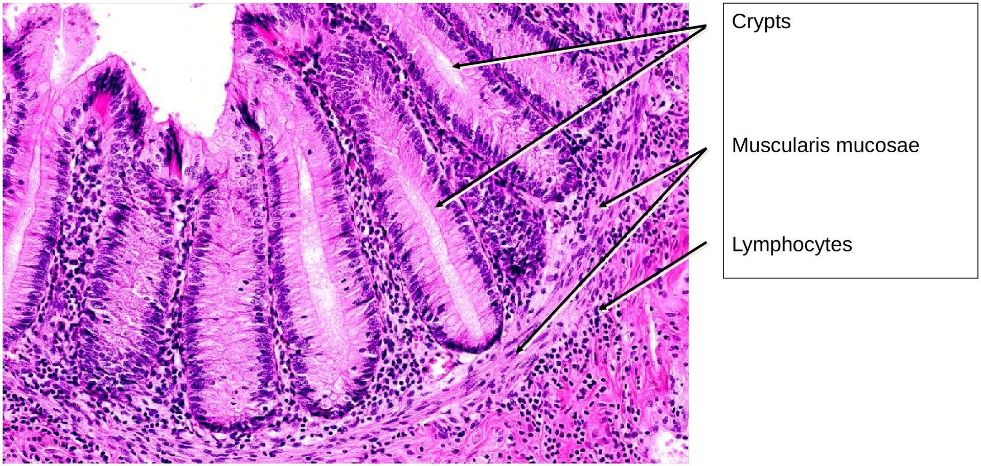 Vermiform appendix