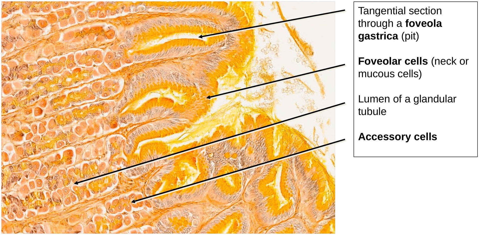 Stomach, fundus