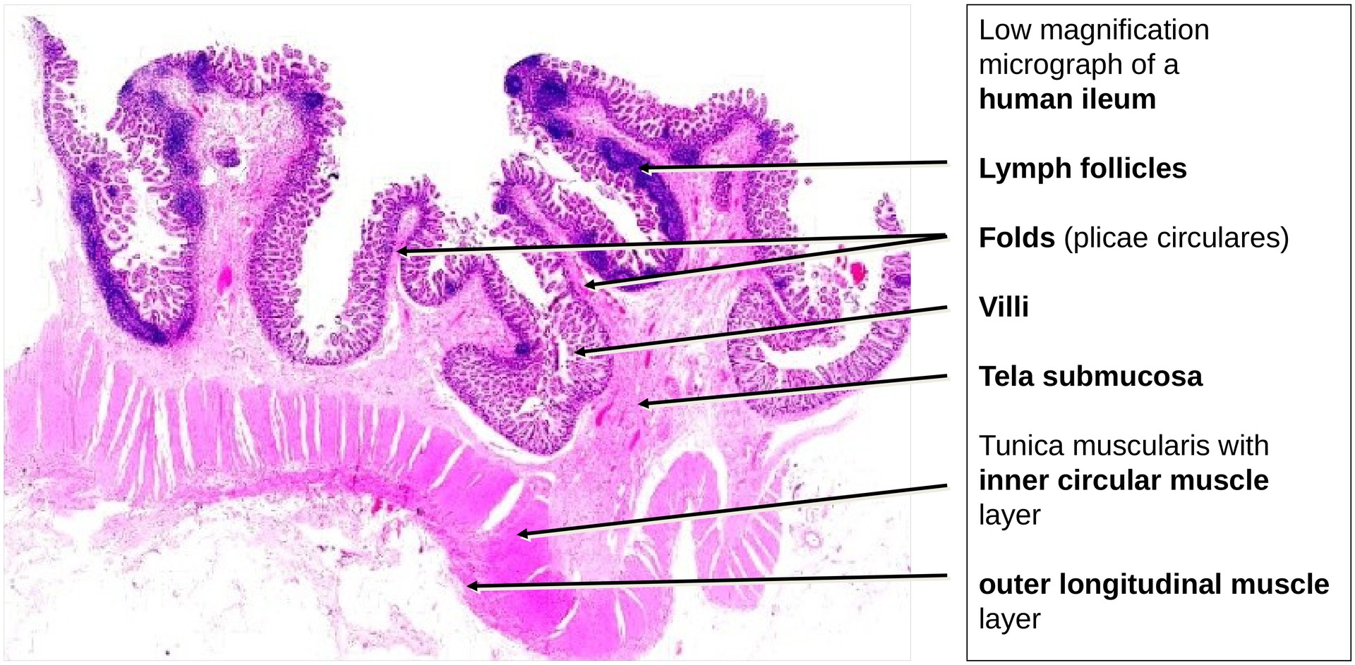 Ileum, Human 2