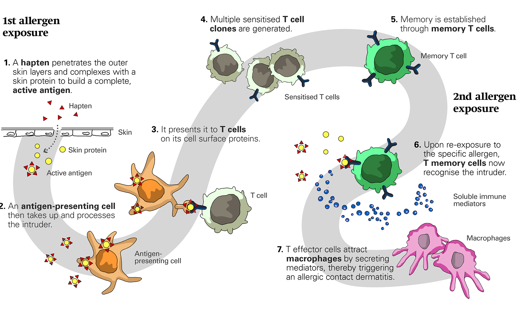 Illustration depicting the mechanisms of allergic contact dermatitis as described in the text below.