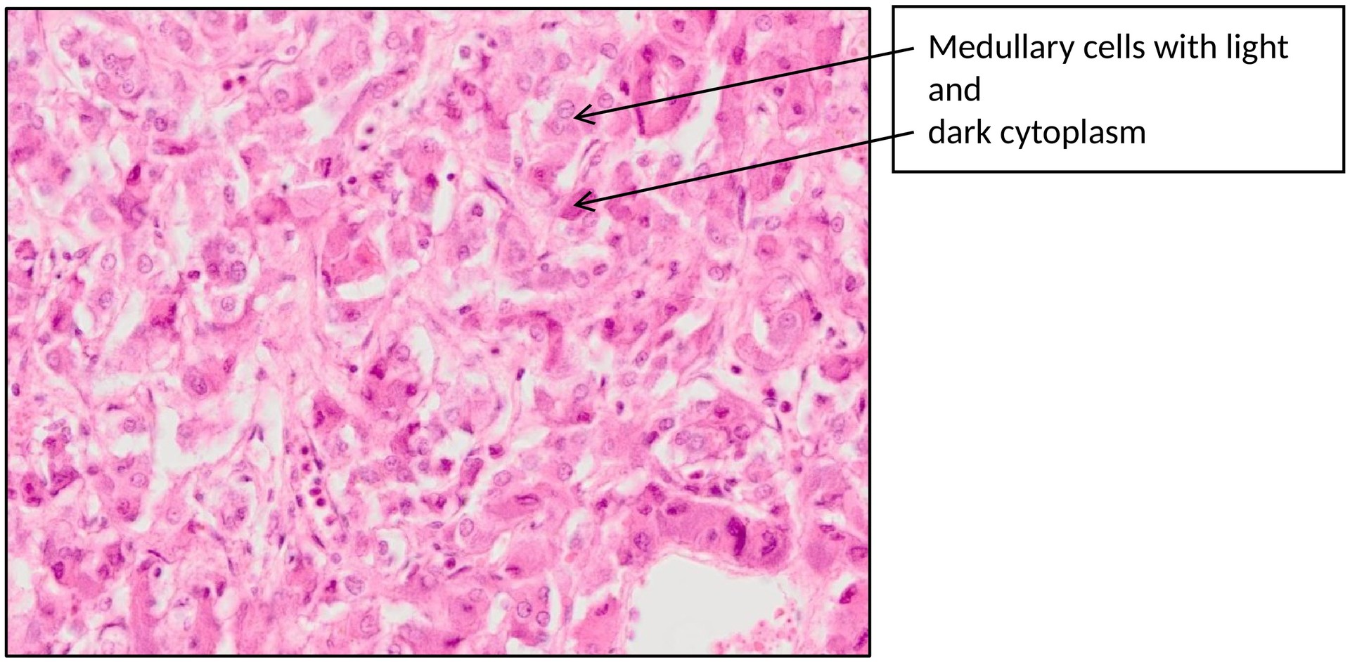 Adrenal gland