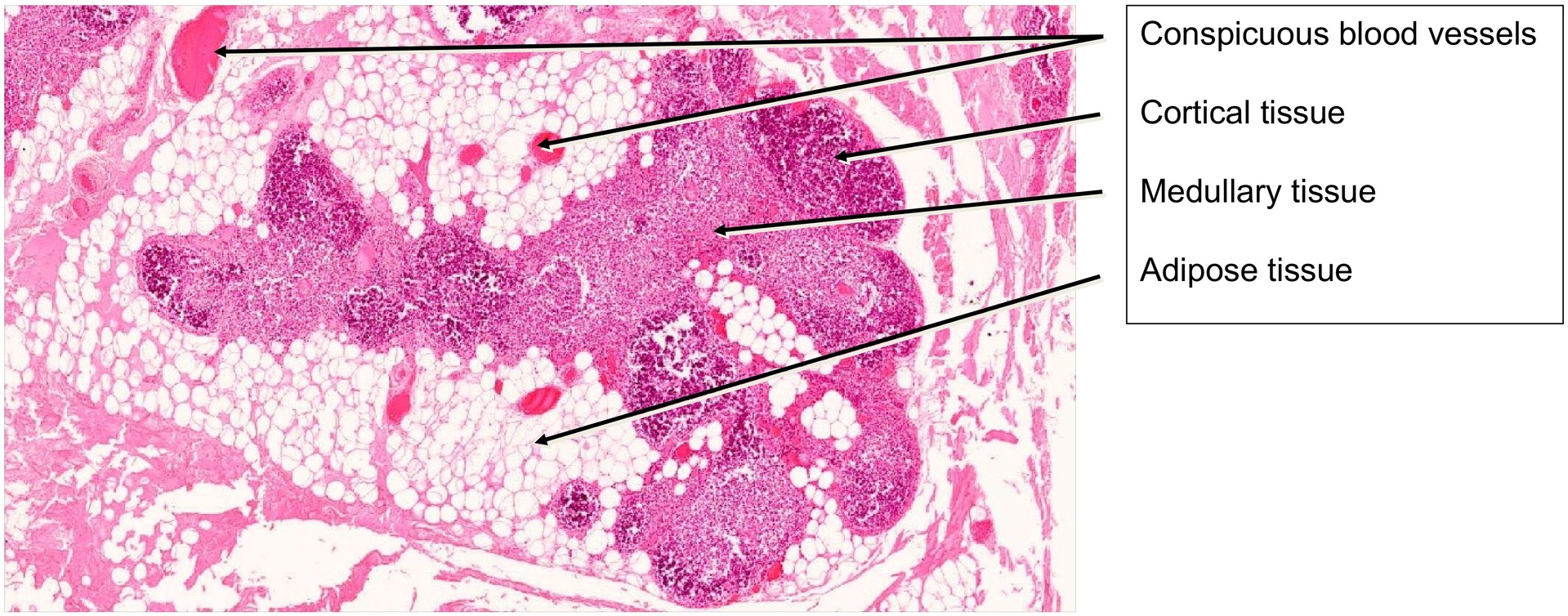 Thymus, adult