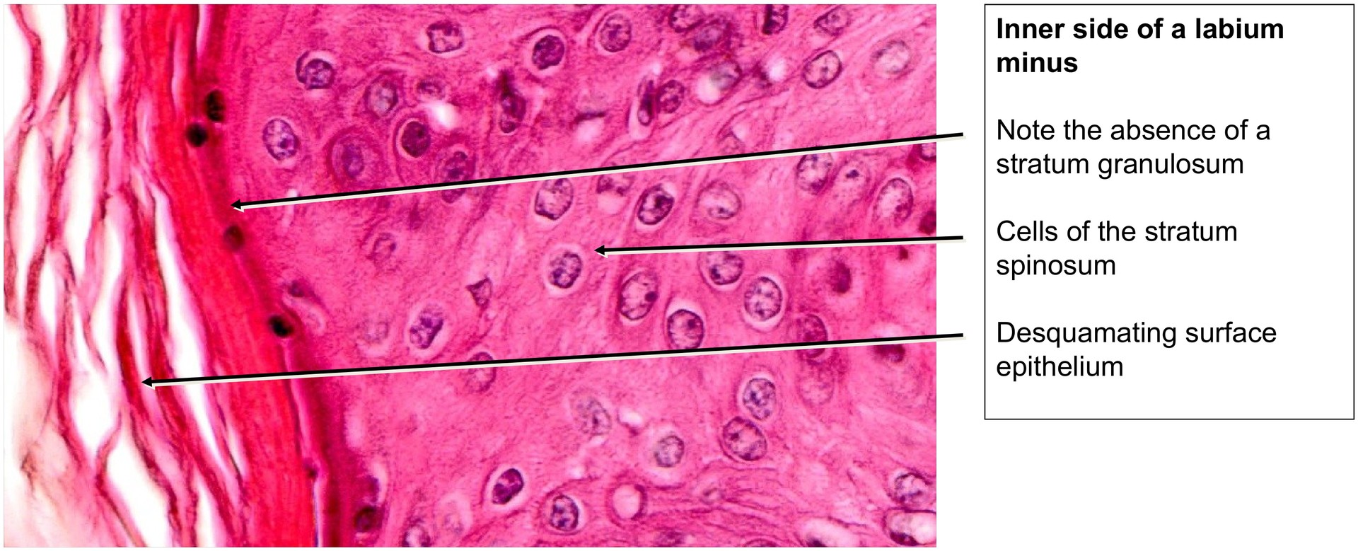 Labium minus