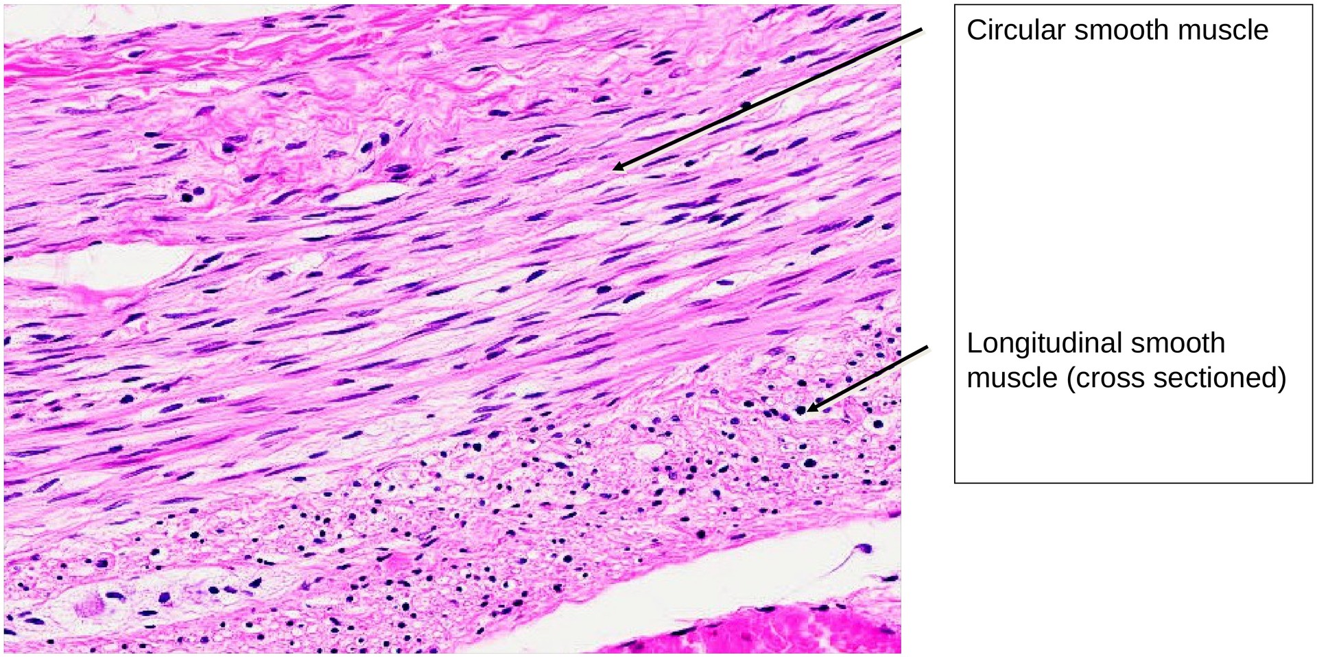 Vermiform appendix