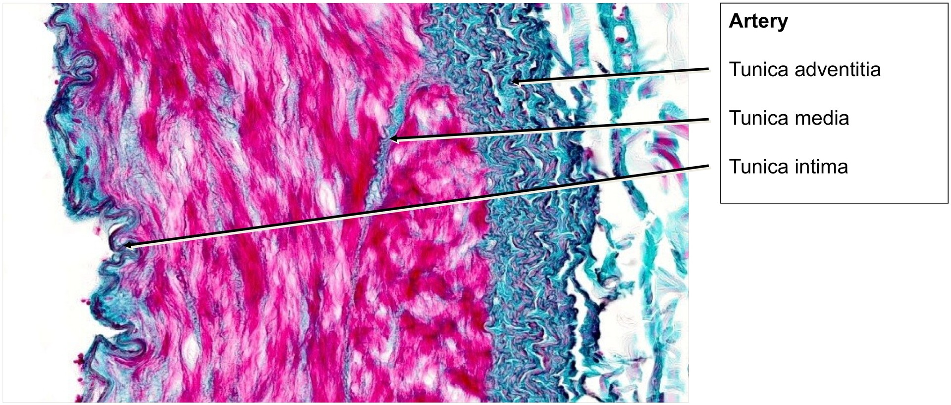 Artery Vein
