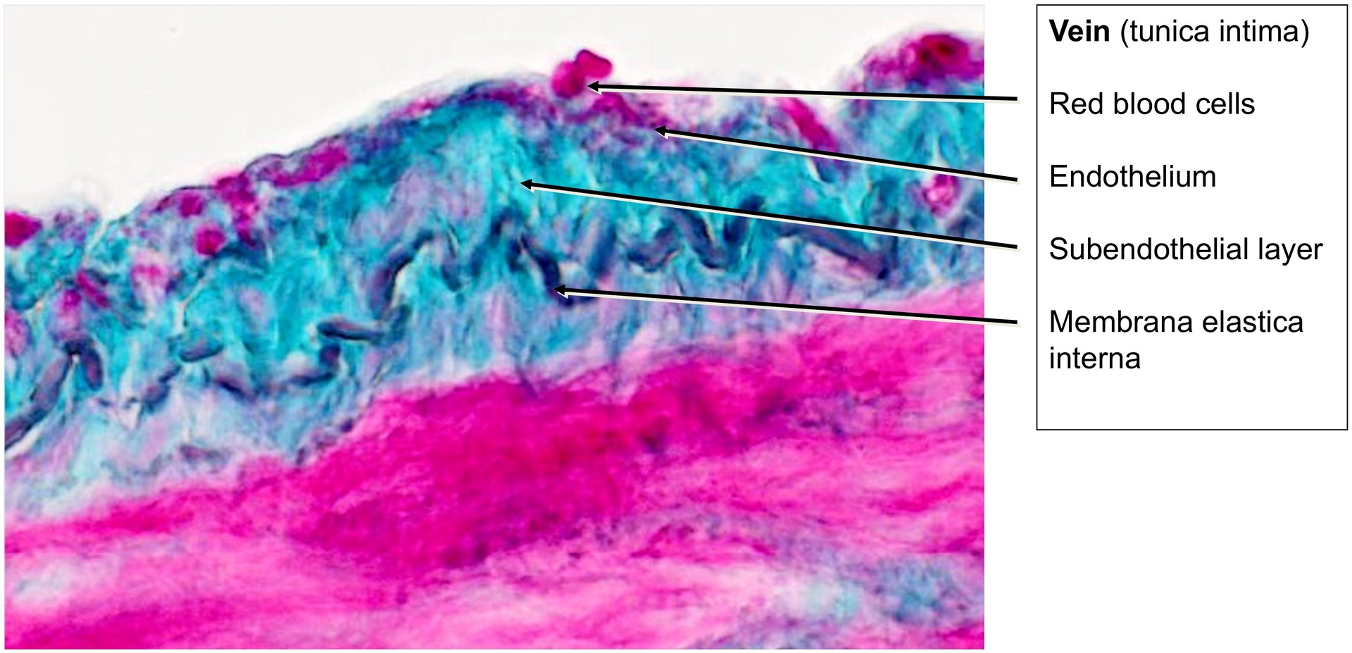 Artery Vein