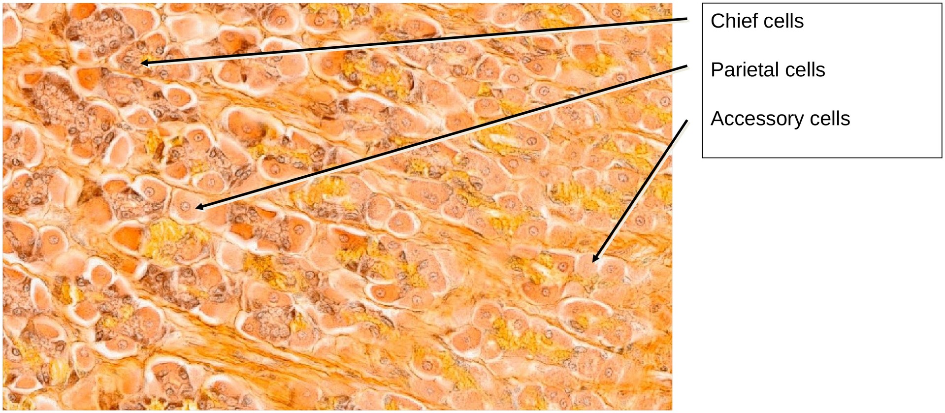 Stomach, fundus
