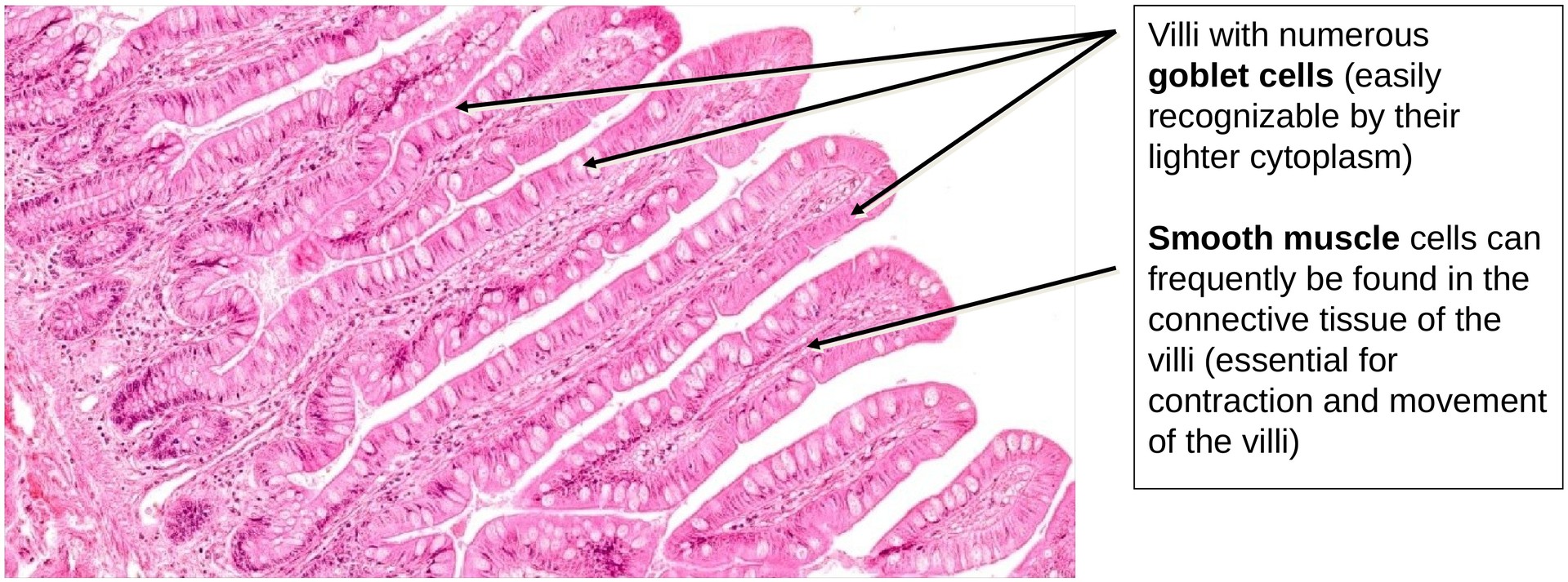 Ileum, Human 1