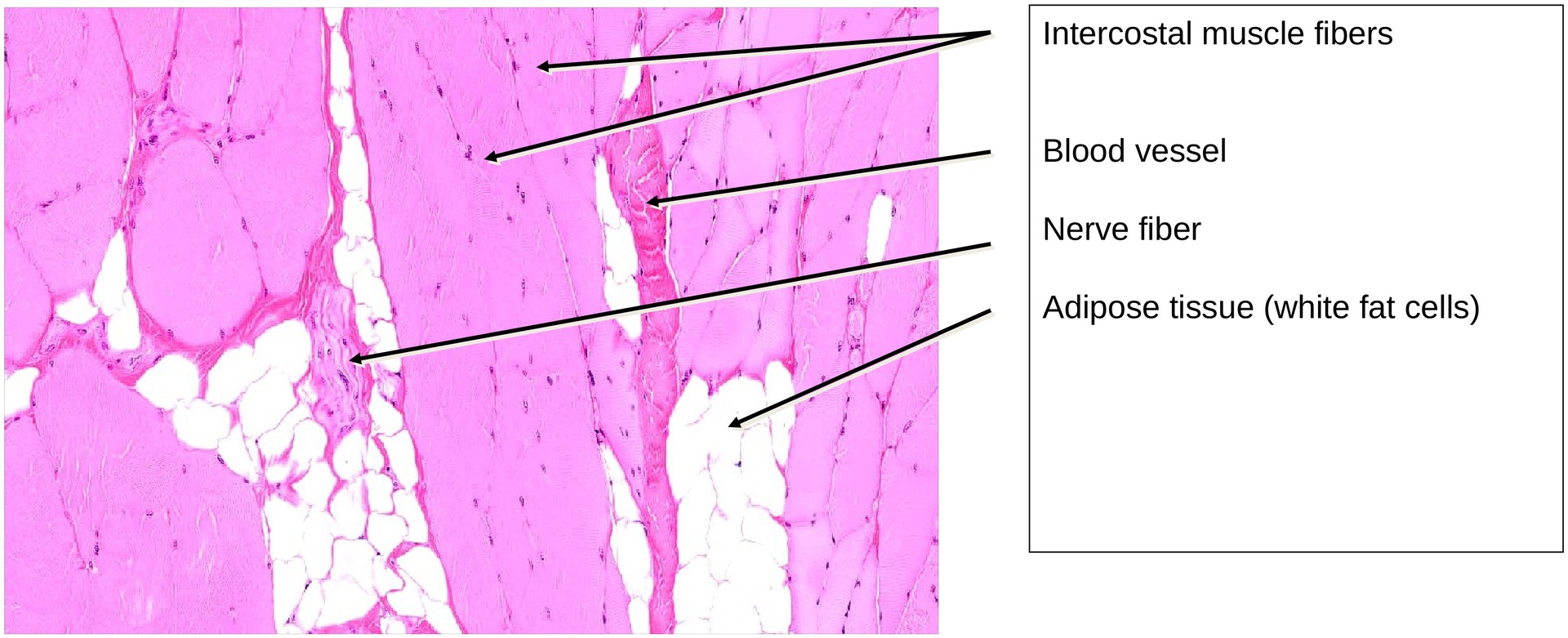 Hyaline cartilage (Rib)