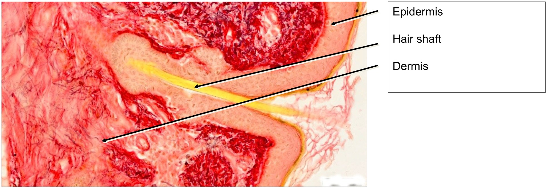 Nasal skin