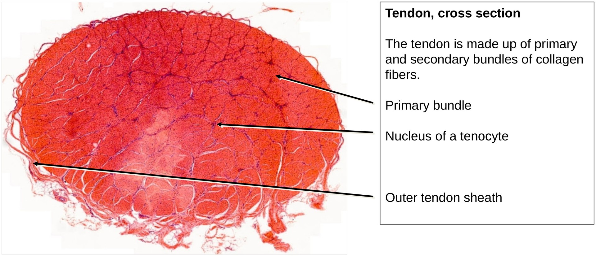 Collagen fibers (Tendon, transverse section)