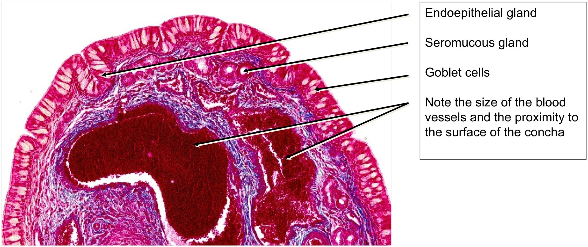 Nasal concha