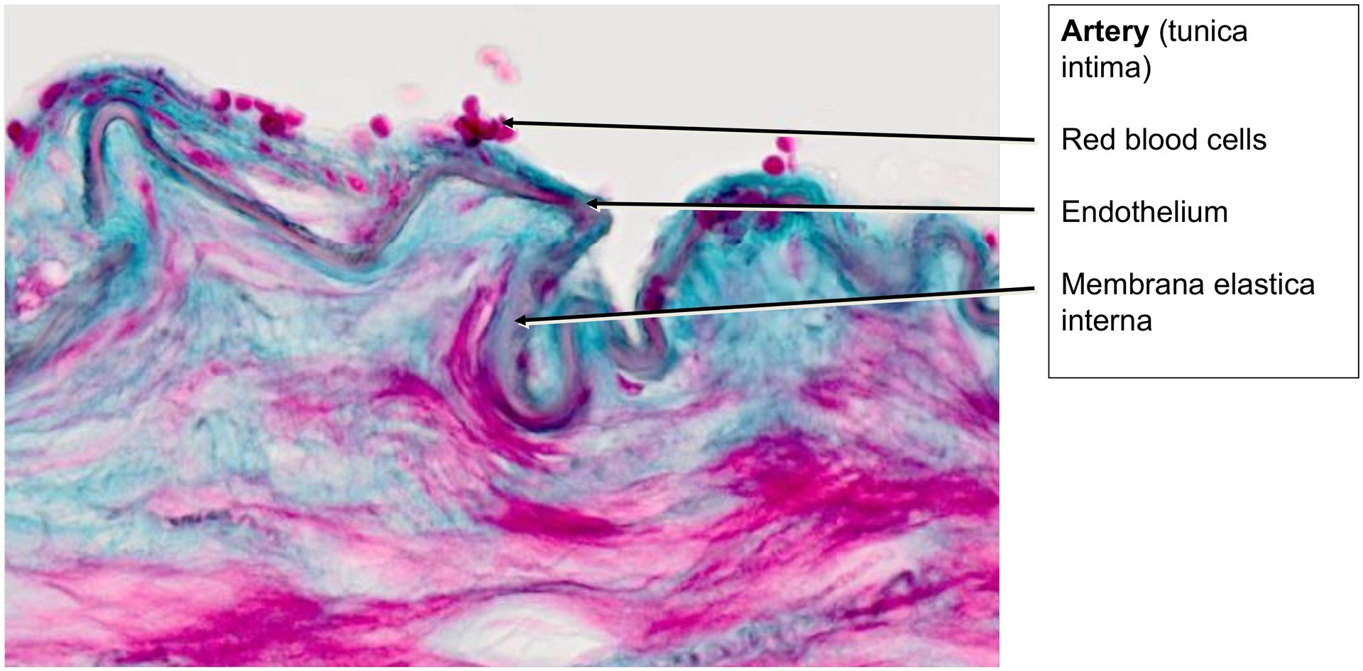 Artery Vein