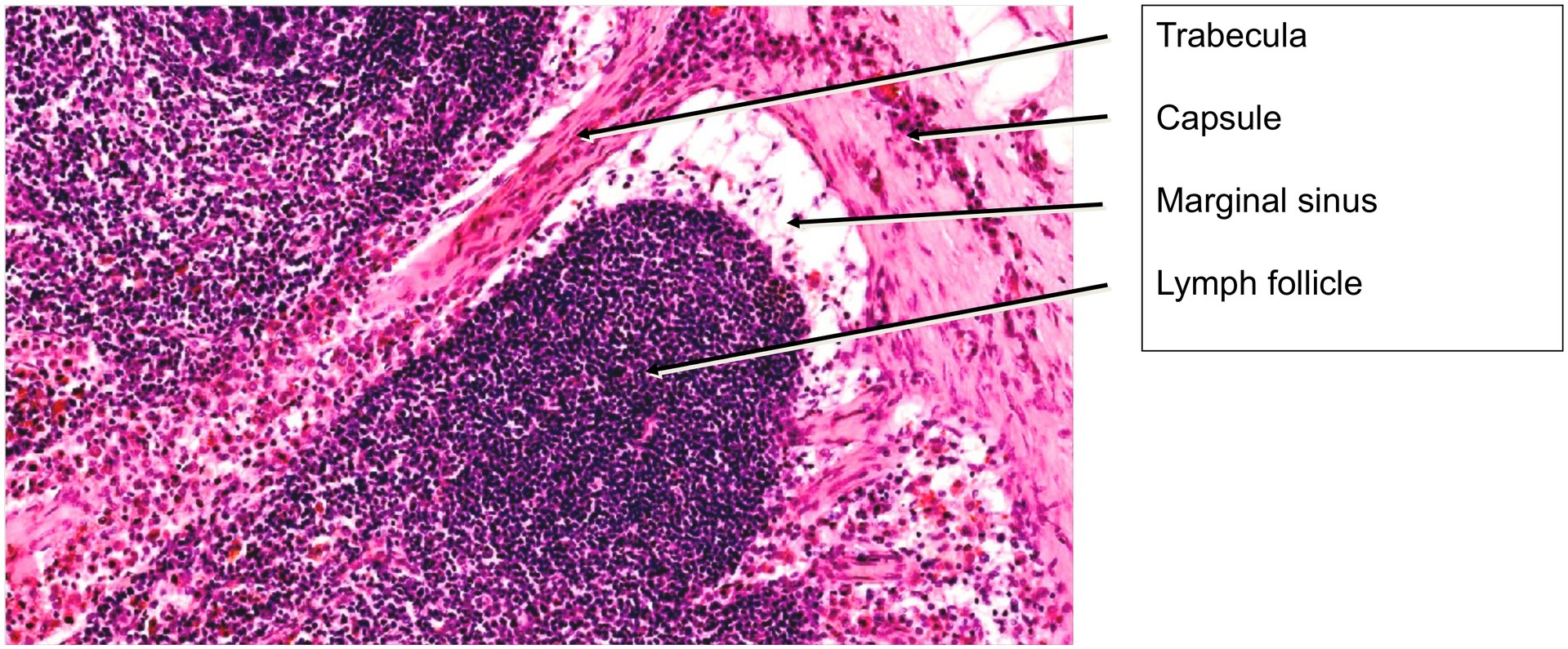 Lymph node, dog