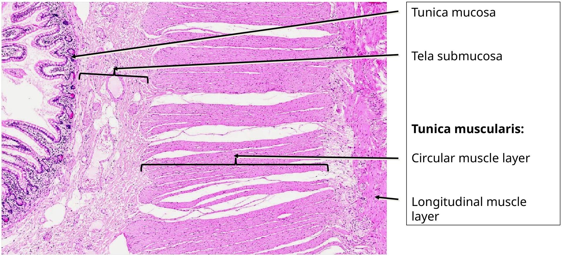 Ileum, Human 2