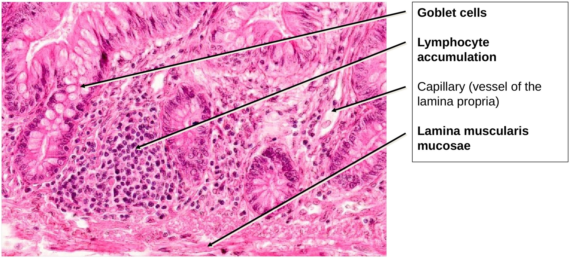 Ileum, Human 1