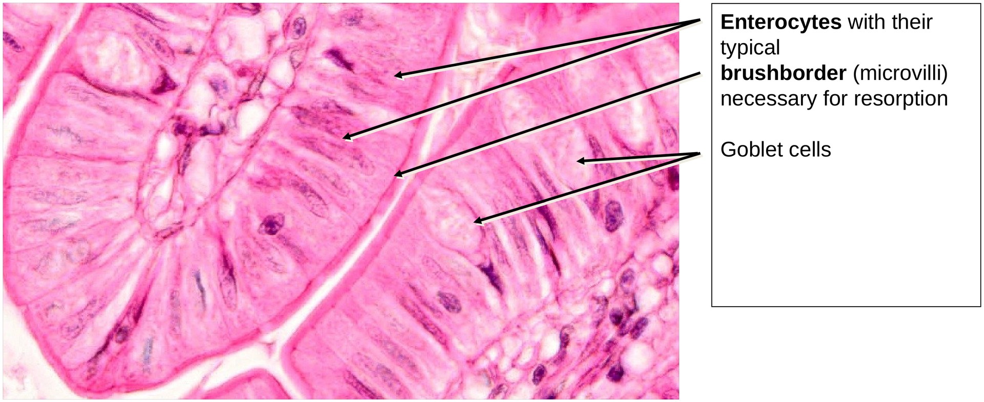 Ileum, Human 1